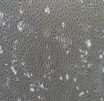 人乳腺癌细胞（三阴性）MDAMB231/LUC(带荧光素酶)