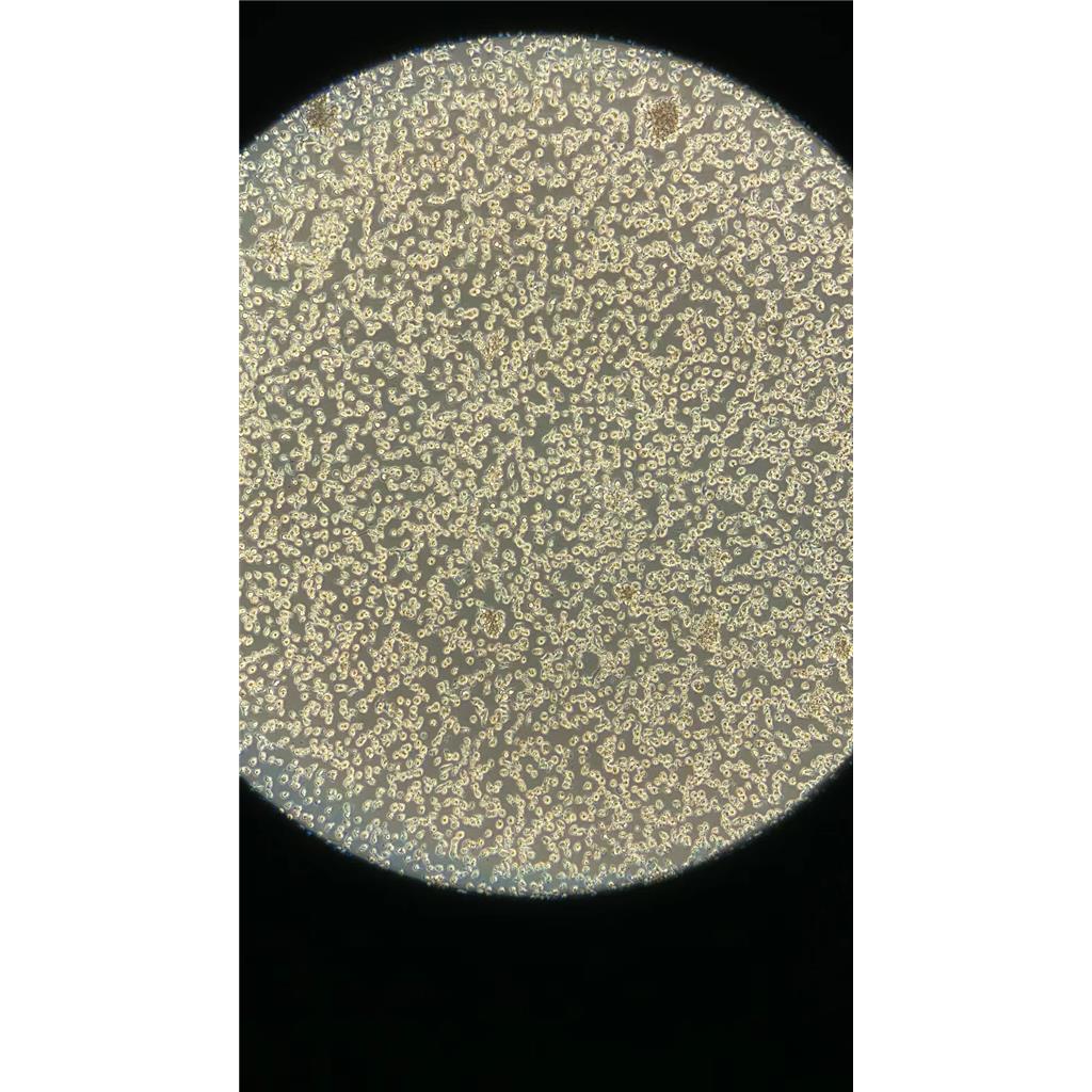 人前列腺正常细胞RWPE1/LUC(带荧光素酶)