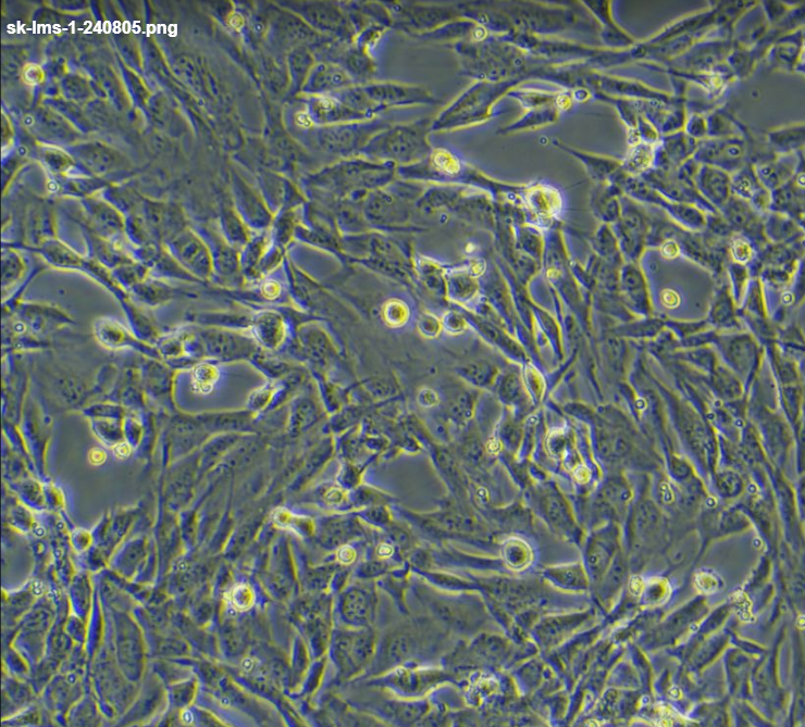 SUNE-2人鼻咽癌细胞/LUC(带荧光素酶)