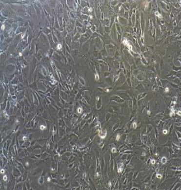 小鼠骨髓巨噬细胞永生化.png 小鼠骨髓巨噬细胞永生化.png