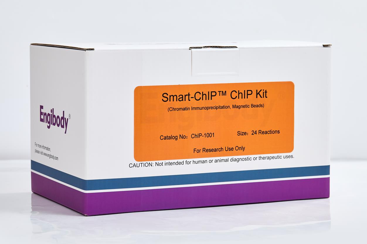 ChIP染色质免疫沉淀试剂盒