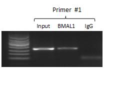 ChIP-PCR
