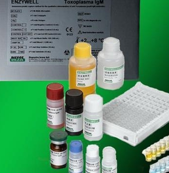 人支原体染料法荧光定量PCR试剂盒Mycoplasma hominis