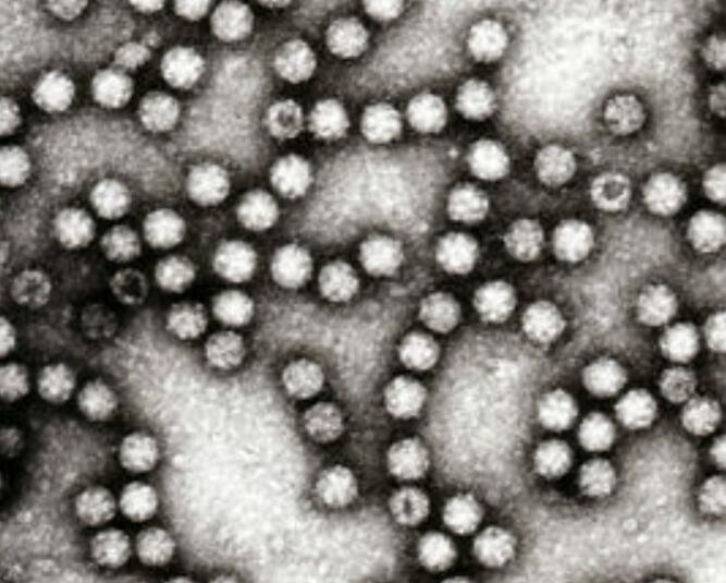 星状病毒结构.jpg 星状病毒结构.jpg