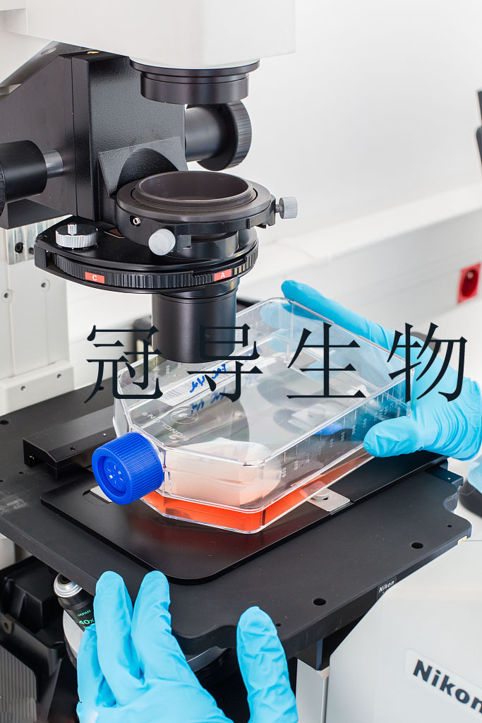 IOMM-Lee Cells人脑膜瘤细胞系(提供STR图谱)