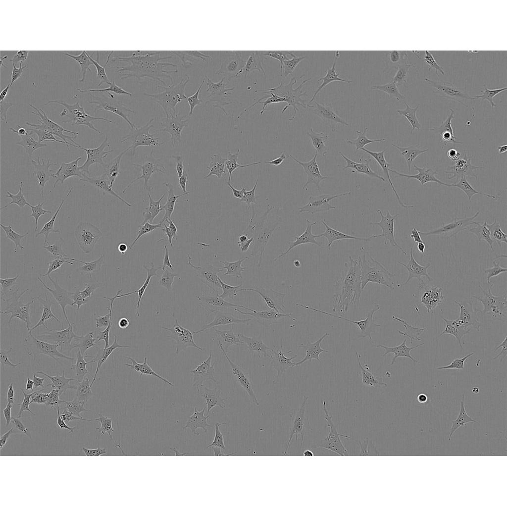 WM115 Cells人恶性黑色素瘤细胞系(提供STR图谱)