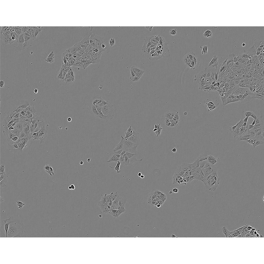 GCT Cells人巨细胞瘤细胞系(提供STR图谱)