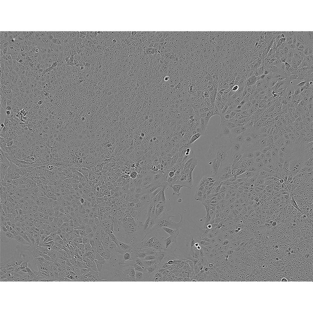 P19[P-19] Cells小鼠畸胎瘤细胞系(提供STR图谱)