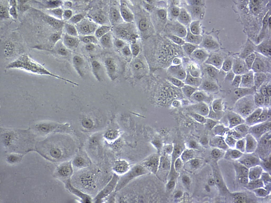 LA-795 Cells小鼠肺腺癌细胞系(提供STR图谱)