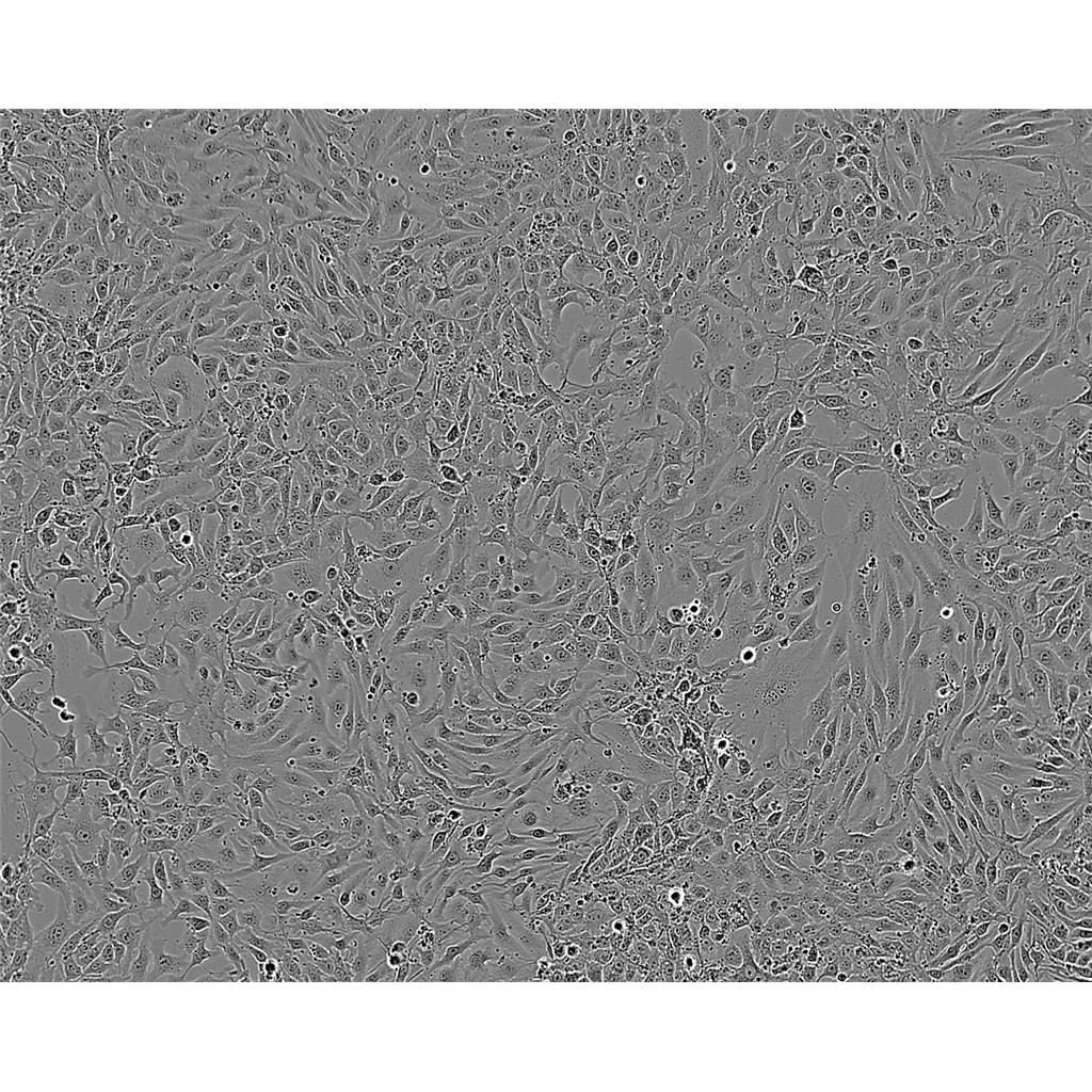 mda MB 436 Cells人乳腺癌细胞系(提供STR图谱)