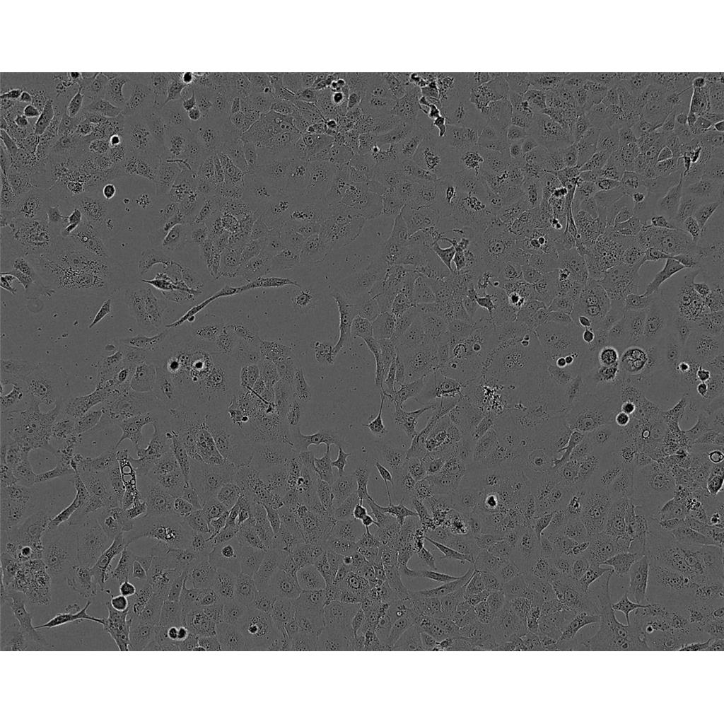 BT 20 Cells人乳腺癌细胞系(提供STR图谱)