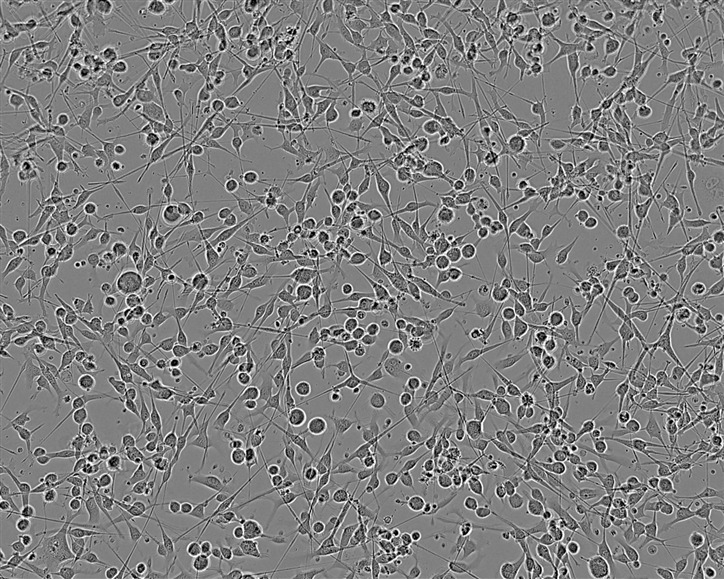 MNNG/HOS Cells人骨肉瘤细胞系(提供STR图谱)
