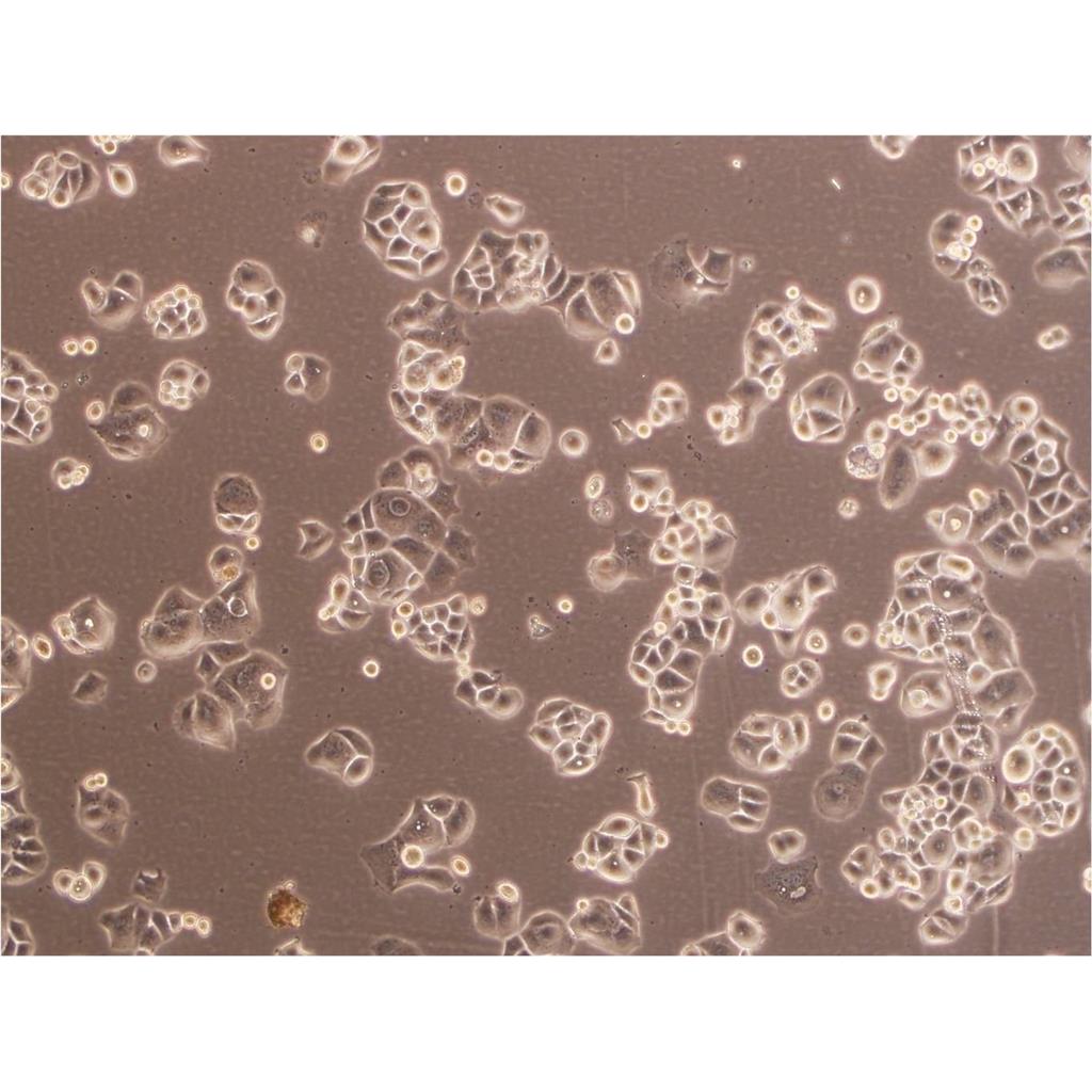 NCI H295R Cells人肾上腺皮质腺癌细胞系(提供STR图谱)