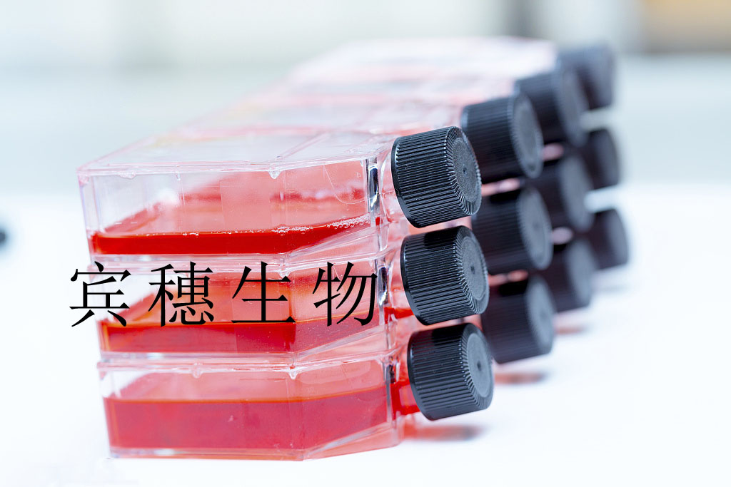 A549[A-549] Cells人非小细胞肺癌复苏细胞系(有STR鉴定图谱)