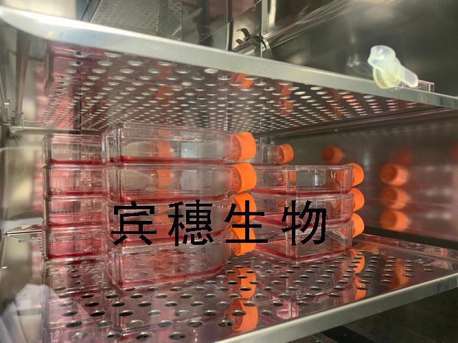 ACHN Cells人肾细胞腺癌复苏细胞系(有STR鉴定图谱)