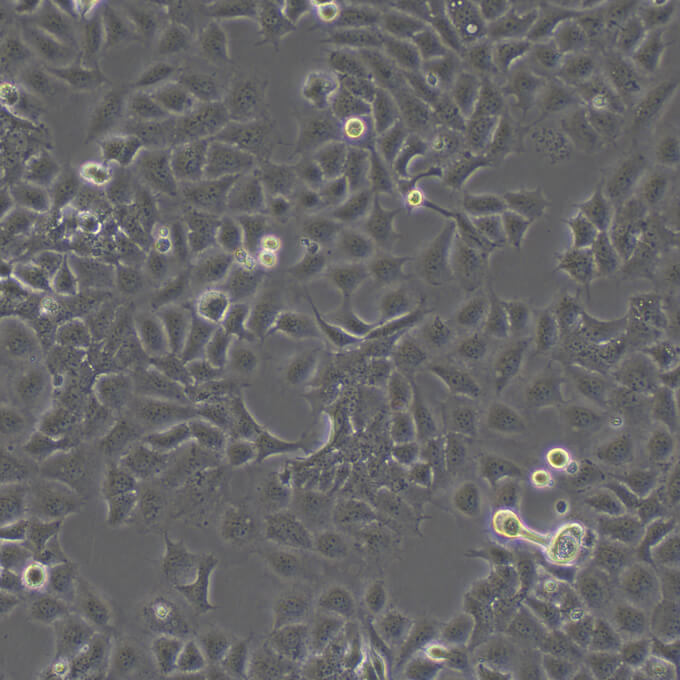 MDA-MB-231 Cells人乳腺癌复苏细胞系(有STR鉴定图谱)