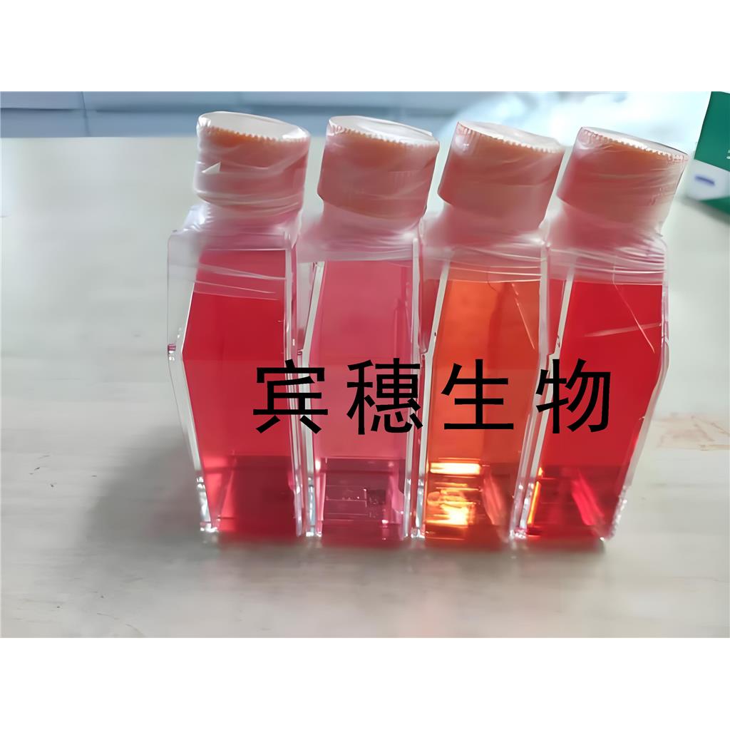MDA-MB-175VII Cells人乳腺导管癌复苏细胞系(有STR鉴定图谱)
