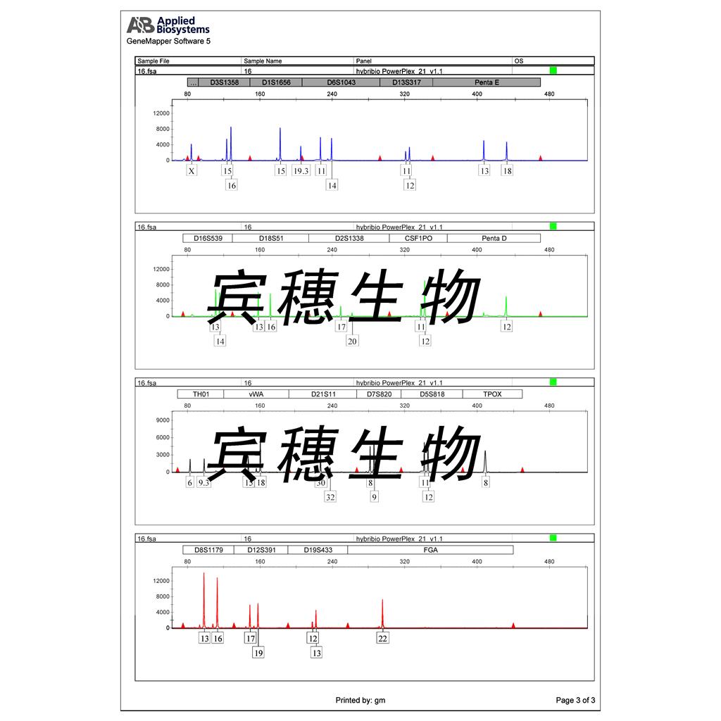 GCT人巨细胞瘤细胞库|培养基|带STR图谱