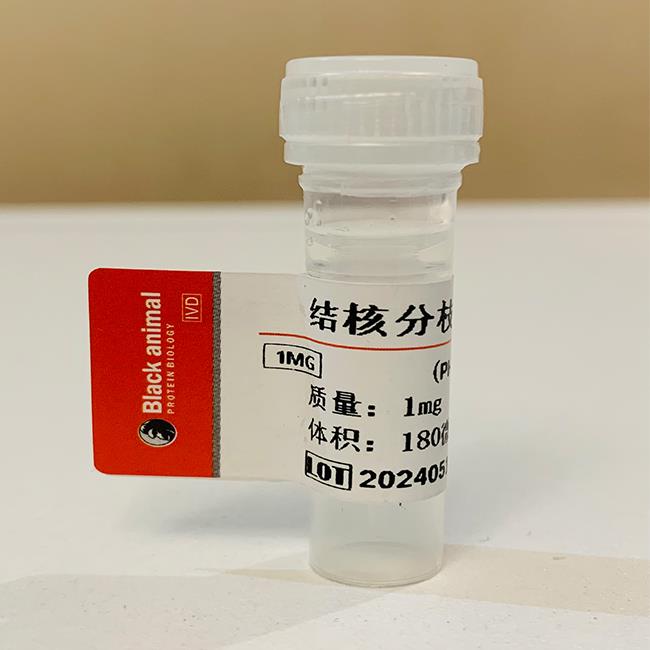 结核分枝杆菌抗体.jpg 结核分枝杆菌抗体.jpg