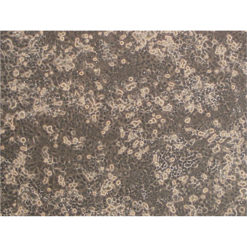 NRK Cells大鼠肾贴壁细胞系(赠送STR基因图谱)