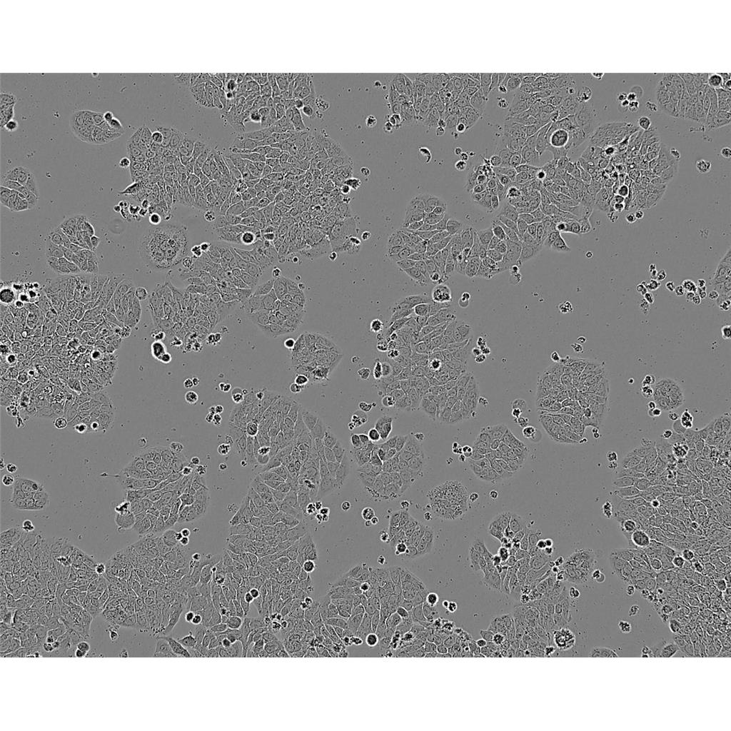 MFE-280 Cells人子宫内膜腺癌贴壁细胞系(赠送STR基因图谱)