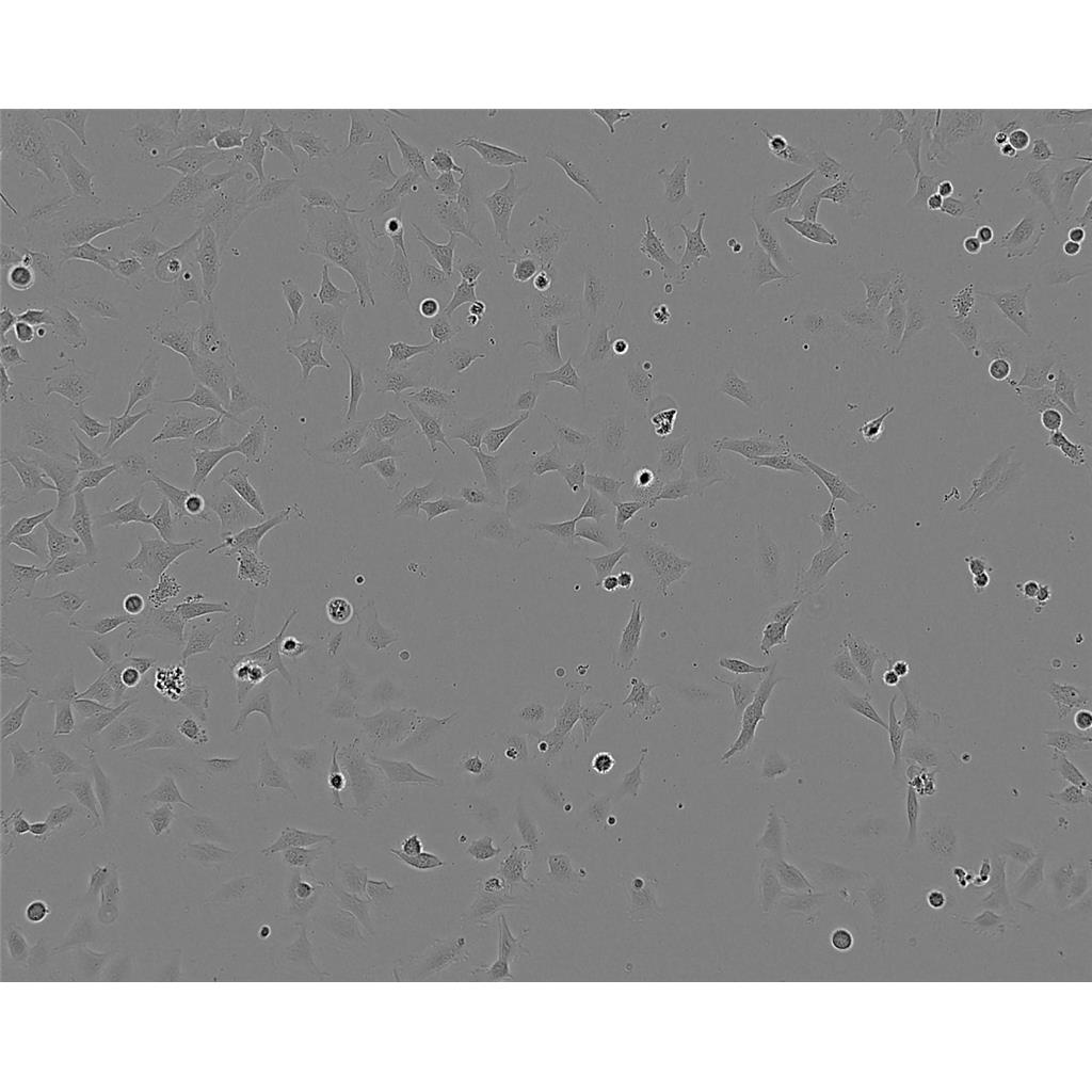 TE-12 Cells人食管癌贴壁细胞系(赠送STR基因图谱)