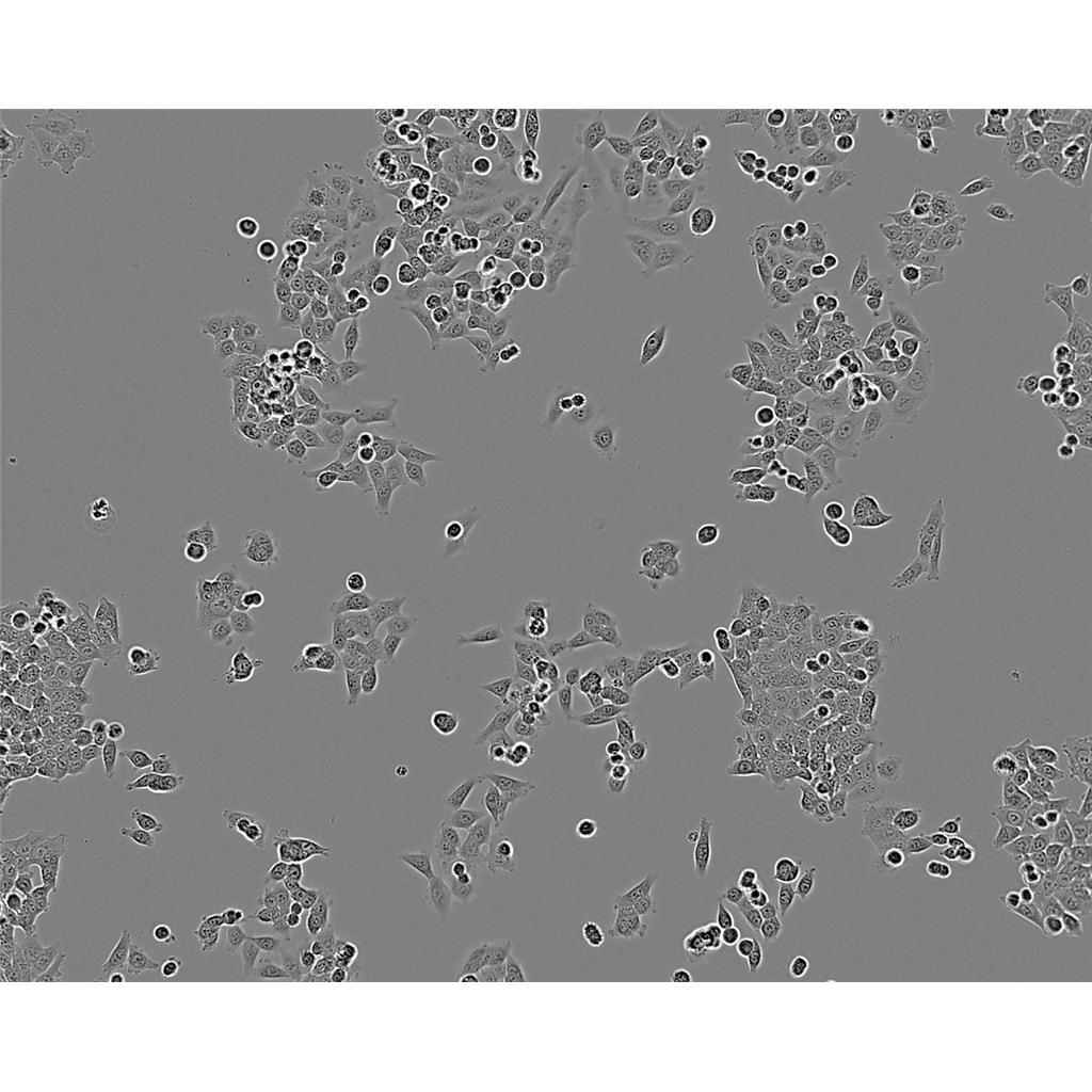 NCI-H1568[H1568] Cells人非小细胞肺癌贴壁细胞系(赠送STR基因图谱)