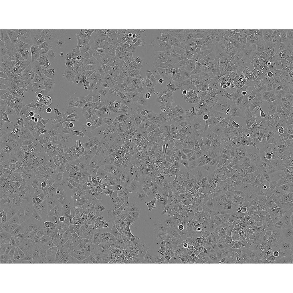 KYSE-150 Cells人食管鳞癌贴壁细胞系(赠送STR基因图谱)
