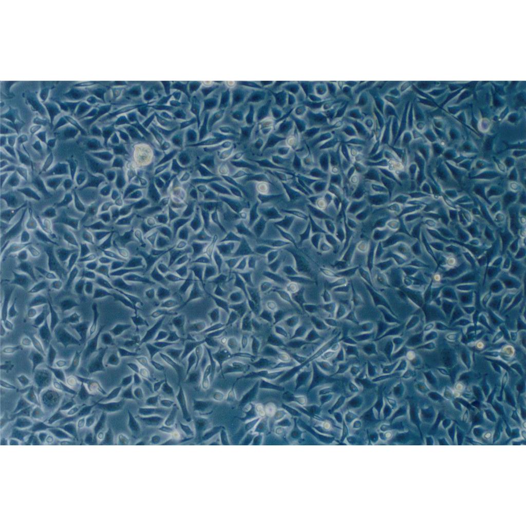 NCI-H69 Cells#人小细胞肺癌细胞系保种中心(通过STR鉴定)