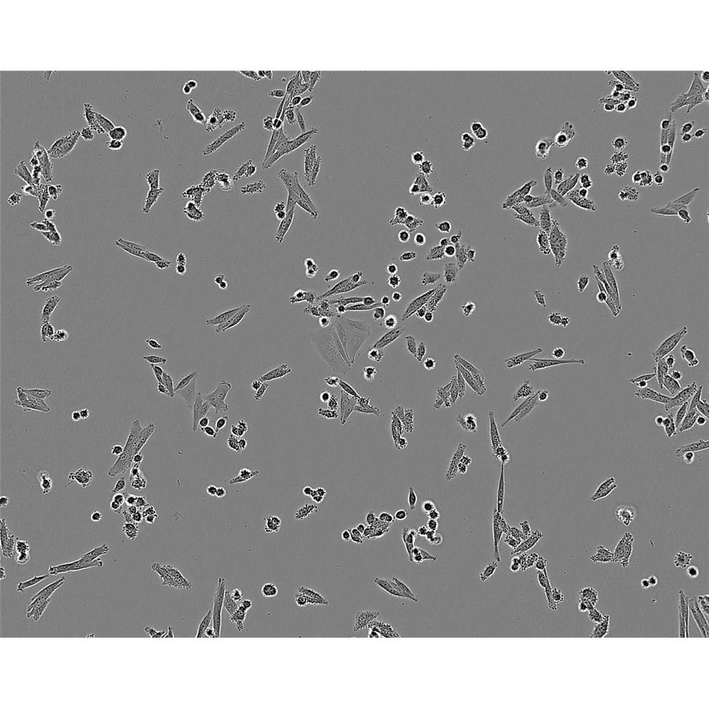 NCI-H647 Cells#人肺癌细胞系保种中心(通过STR鉴定)