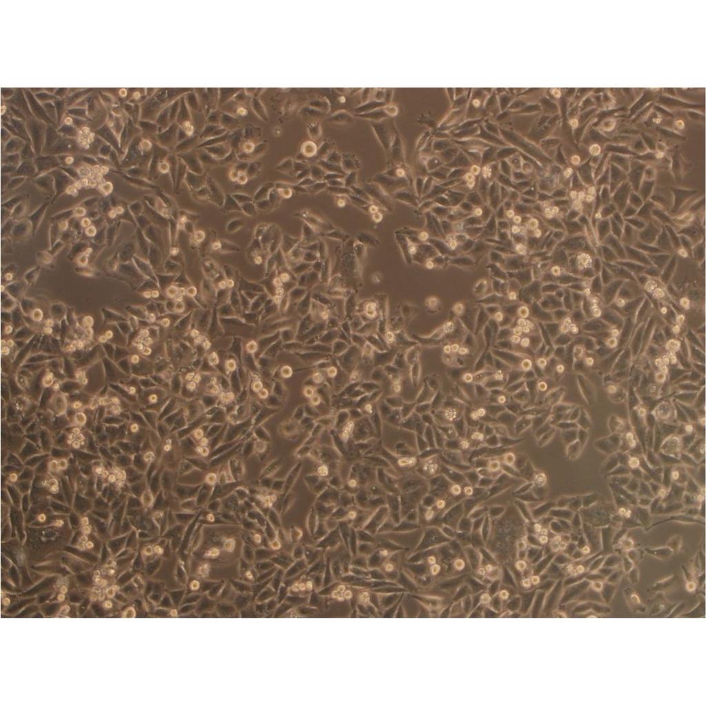 B16/F1 Cells小鼠黑色素瘤可传代细胞系(送STR鉴定图谱)