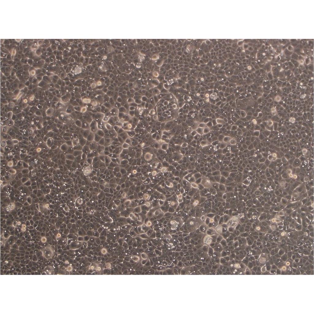 Calu-6 Cells#人退行性癌细胞系来源可靠|培养基|带STR基因图谱