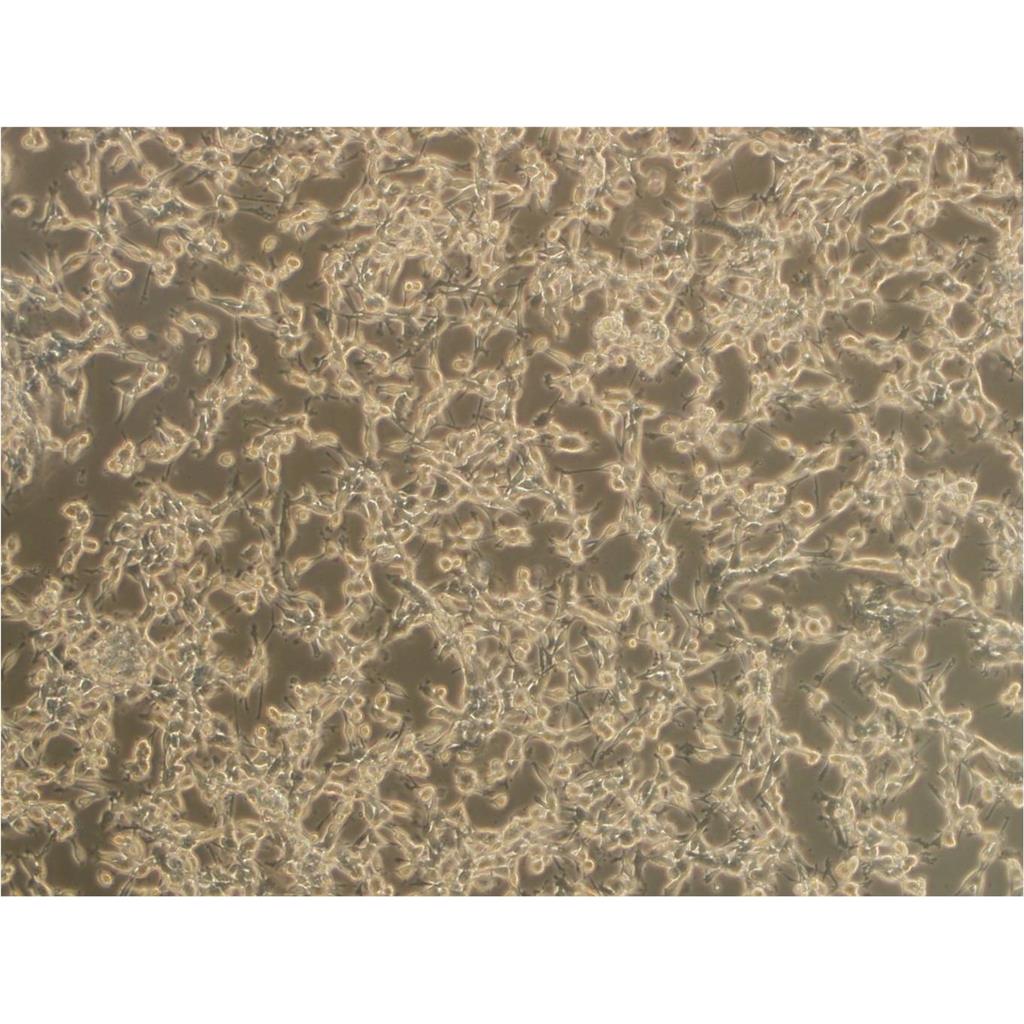 CAKI 1 Cells#人肾透明细胞癌细胞系种子库|完全培养基|STR图谱