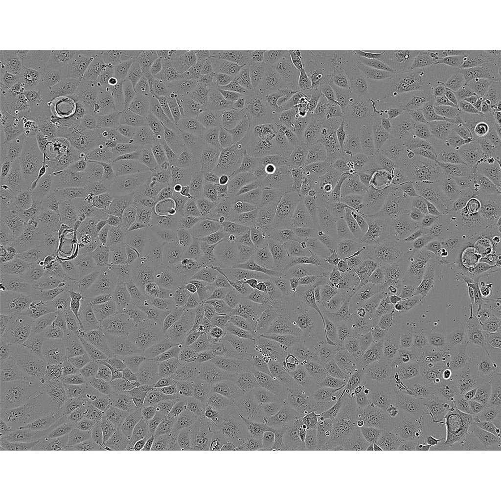 MV4:11 Cells#人急性单核细胞系种子库|完全培养基|STR图谱