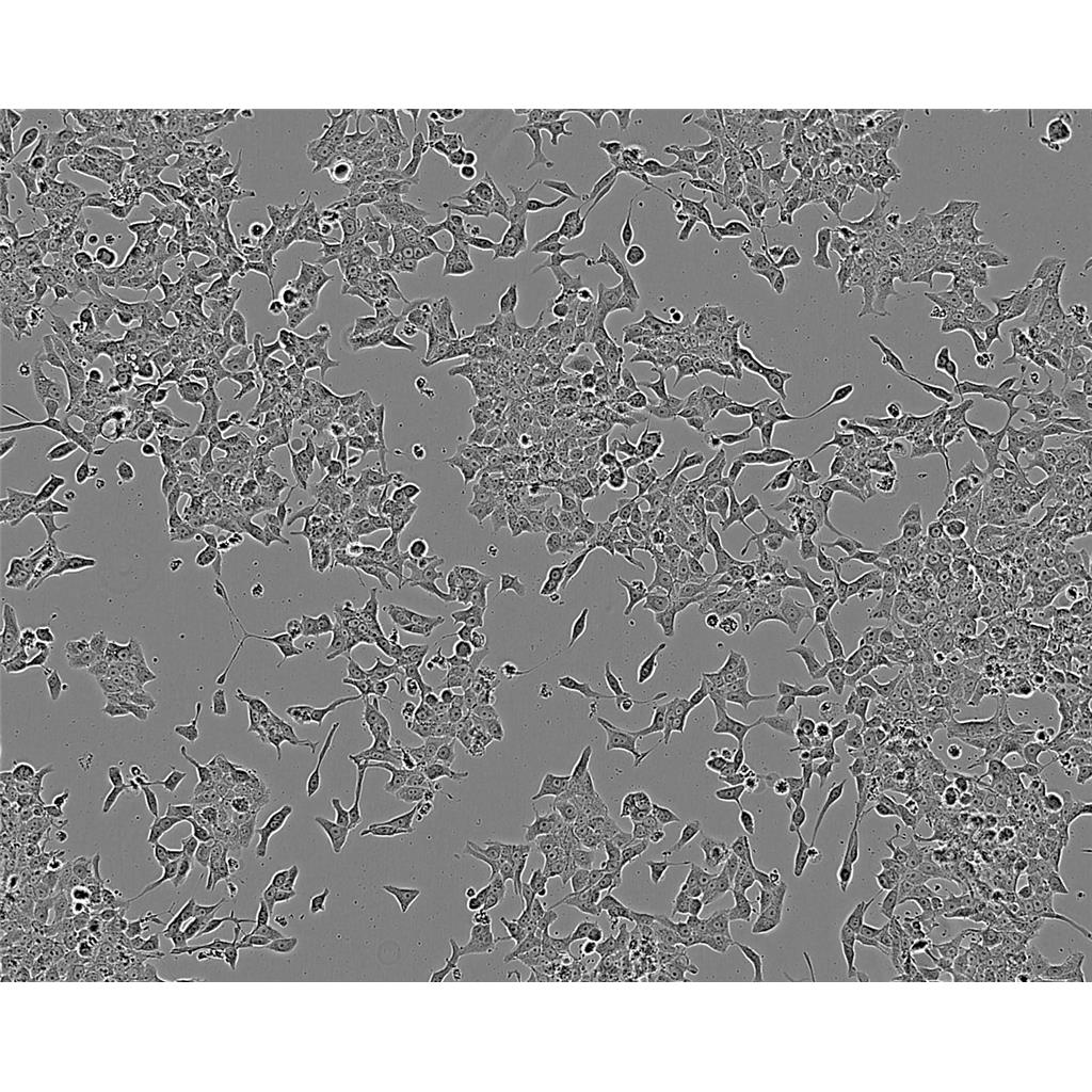 H1299 Cells#人非小细胞肺癌细胞系种子库|完全培养基|STR图谱