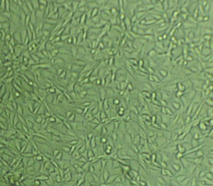 A204 Cells#人横纹肌肉瘤细胞系种子库|完全培养基|STR图谱