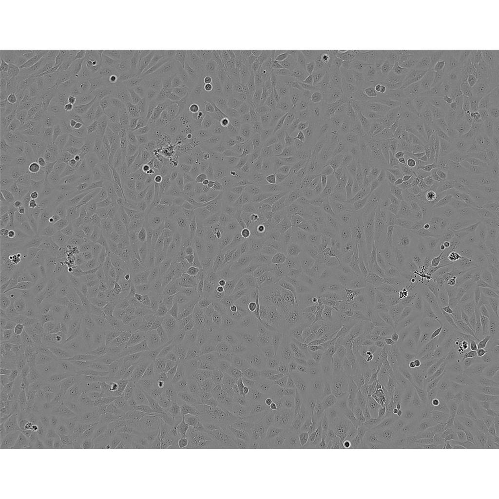 Ramos Cells#人B淋巴细胞系种子库|完全培养基|STR图谱