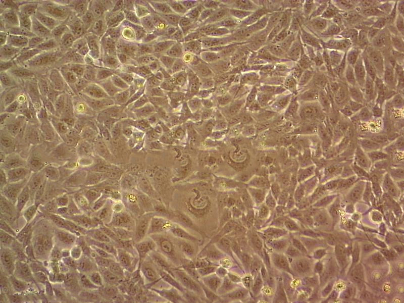RenCa Cells#小鼠肾癌细胞系种子库|完全培养基|STR图谱