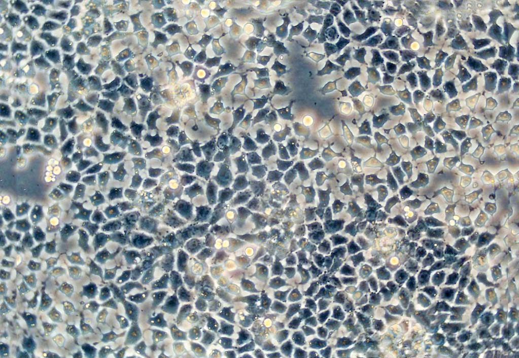 E.L.4 Cells#EL4小鼠淋巴瘤细胞系低代次|培养基|赠STR图谱