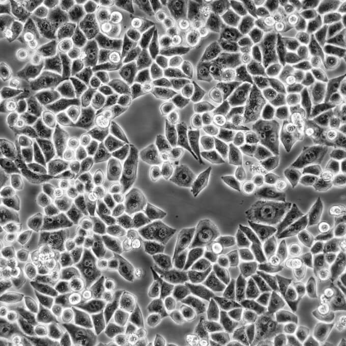 H-1299 Cells#人非小细胞肺癌细胞系低代次|培养基|赠STR图谱