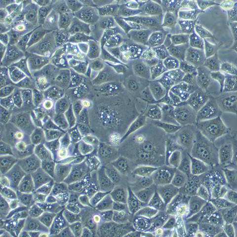 H1703 Cells#人肺腺鳞癌细胞系低代次|培养基|赠STR图谱