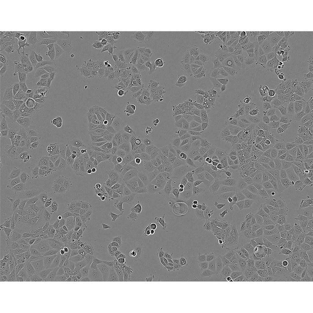 LN-18 Cells#人胶质母细胞瘤细胞系低代次|培养基|赠STR图谱
