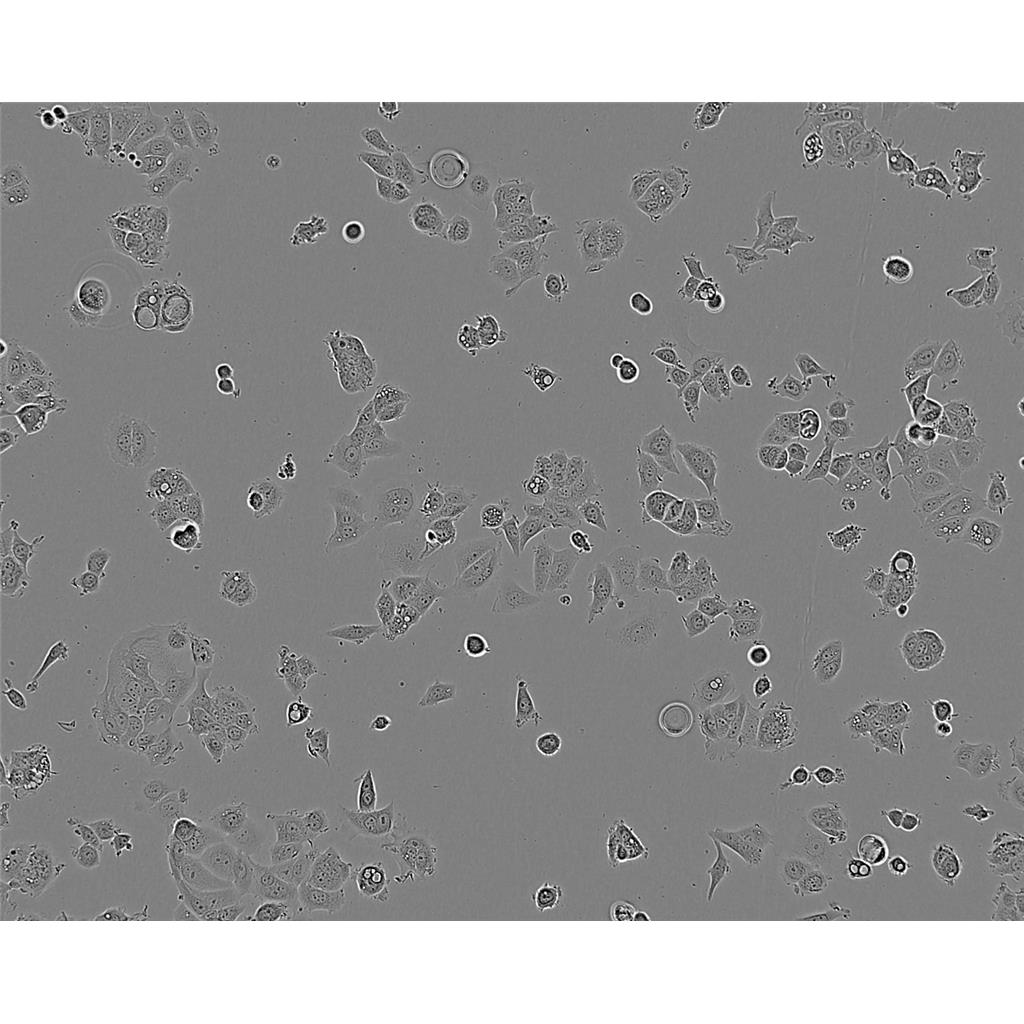 TE-12 Cells#人食管癌细胞系低代次|培养基|赠STR图谱