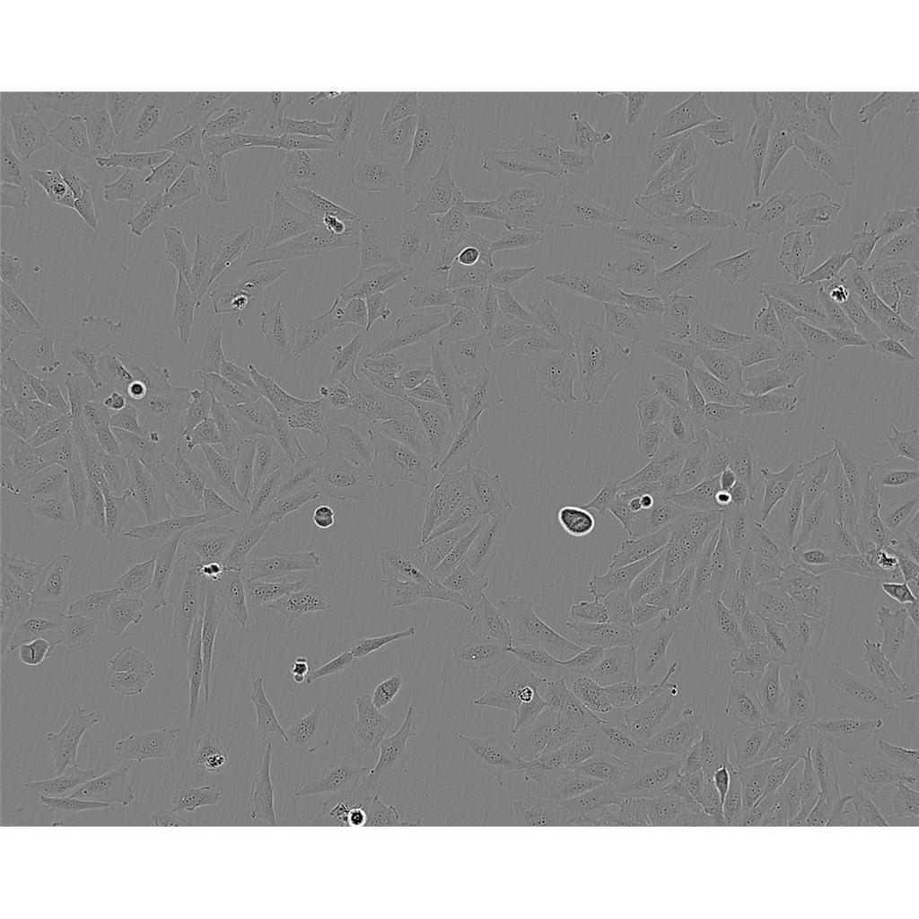 HPAC Cells#人胰腺腺泡上皮癌细胞系低代次|培养基|赠STR图谱