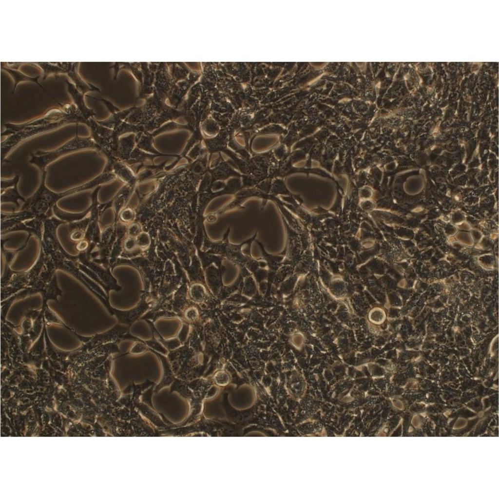 NCI-SNU-1 Cells#人胃癌细胞系来源可靠|培养基|带STR基因图谱