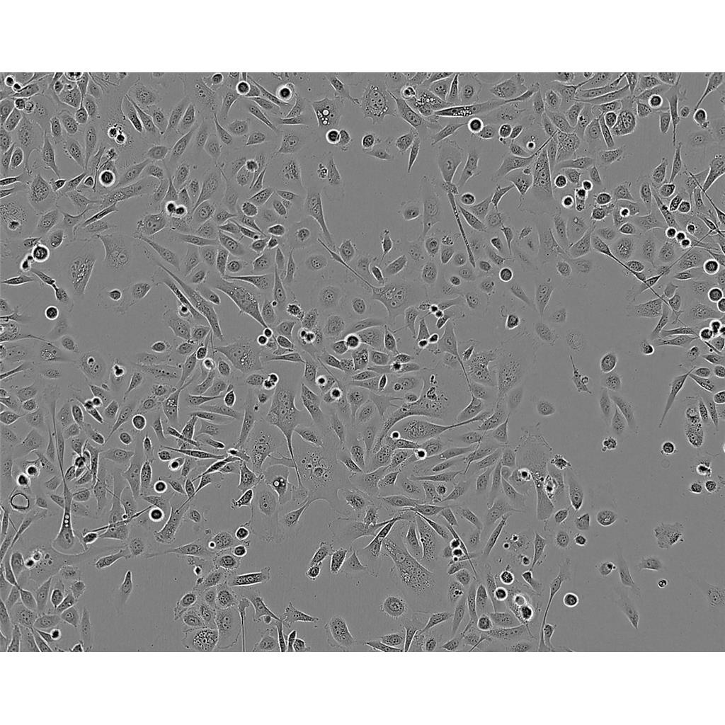 E0771 Cells#小鼠髓样乳腺癌细胞系来源可靠|培养基|带STR基因图谱