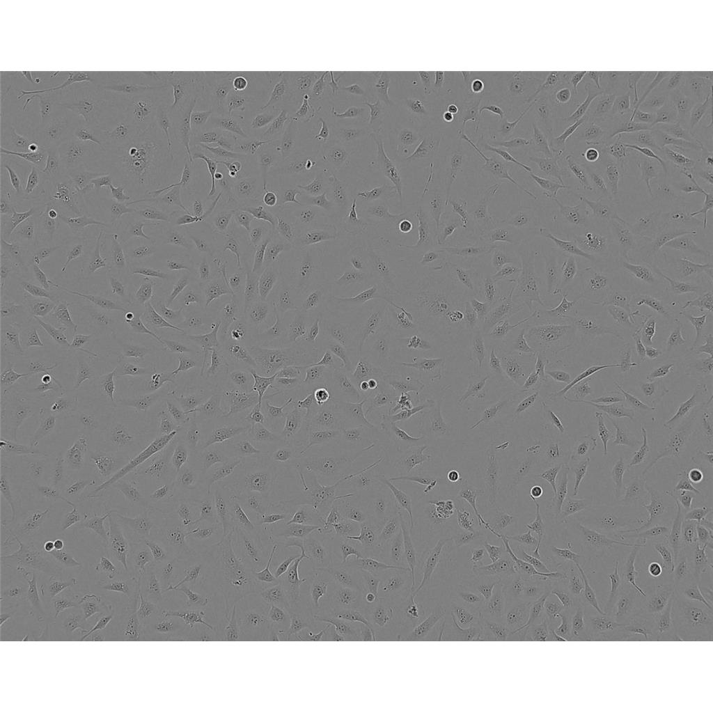 NCI-H2444 Cells#人非小细胞肺癌细胞系来源可靠|培养基|带STR基因图谱