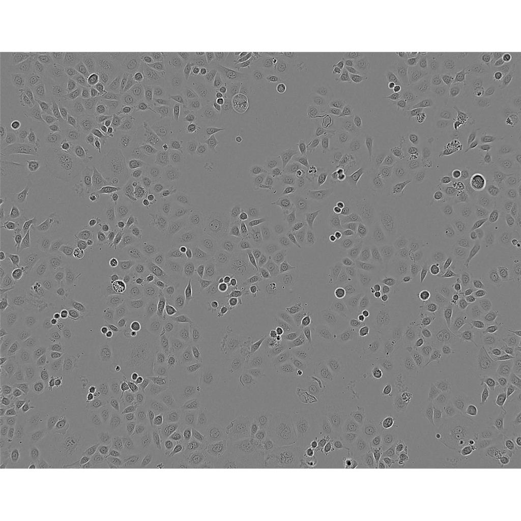 LN-18 Cells#人胶质母细胞瘤细胞系来源可靠|培养基|带STR基因图谱