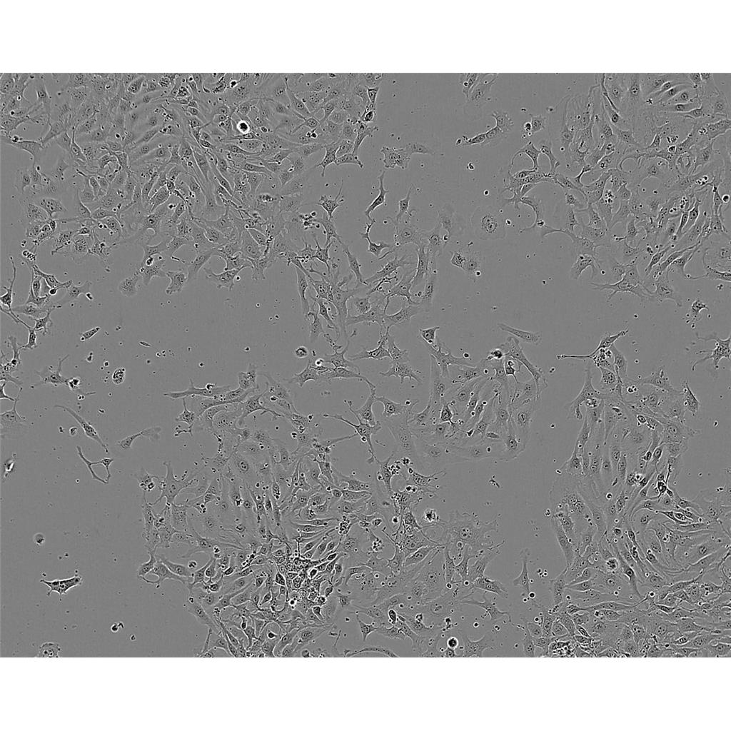 WSU-HN30 Cells#人口腔鳞状细胞系来源可靠|培养基|带STR基因图谱