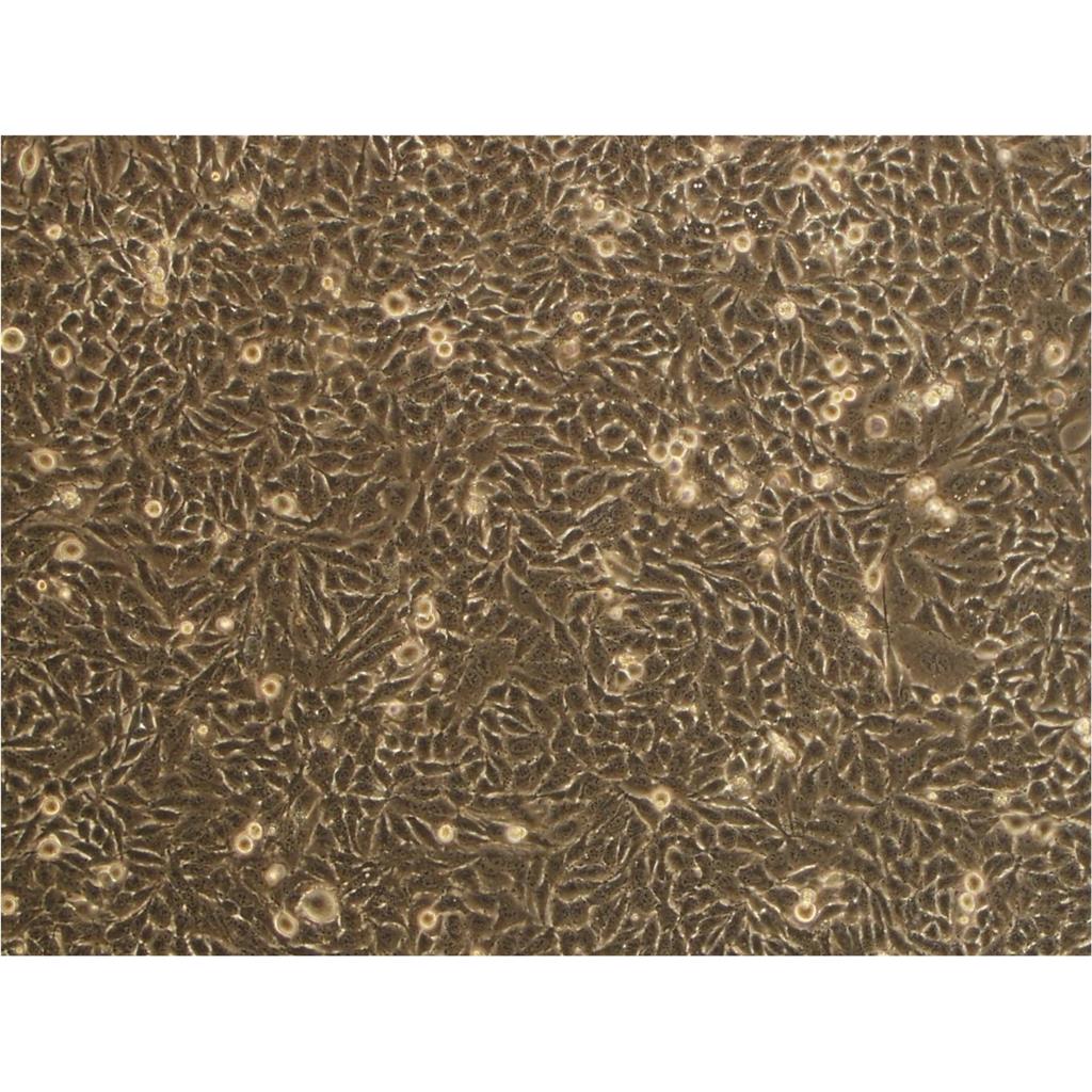 脑心浸出液肉汤培养基[源头供货]